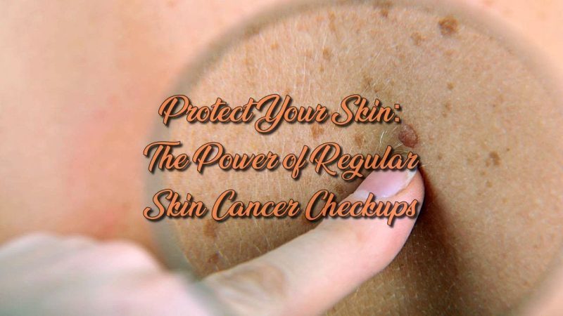 Protect Your Skin: The Power of Regular Skin Cancer Checkups