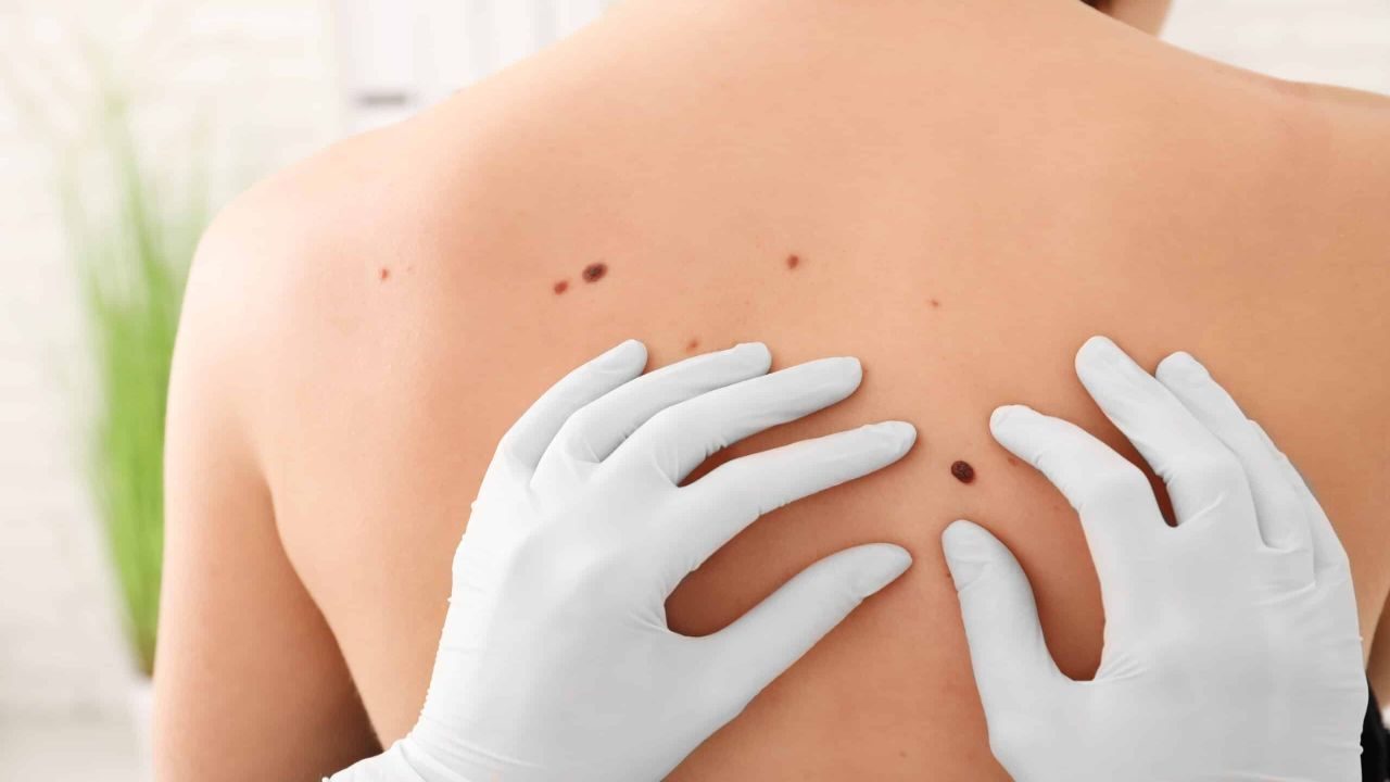Why Early Detection Matters